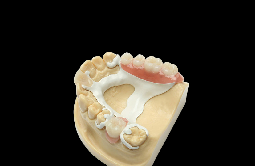 PAEK (Polyaryletherketone)